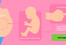 Photo of Гестационный диабет: причины и лечение