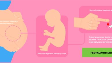 Photo of Гестационный диабет: причины и лечение