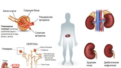 Photo of Классификация диабетической нейропатии