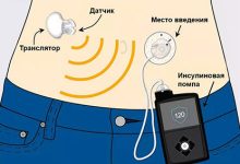 Photo of Новинки в лечении диабета