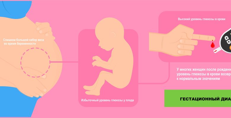 Photo of Гестационный диабет: причины и лечение