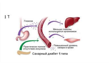 Photo of Понимание диабета: ключевые аспекты