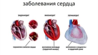 Photo of Диабет и сердечно-сосудистые заболевания: связь и профилактика